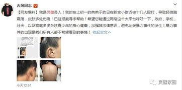 小美弟弟爆料了吗视频在线观看,揭秘幕后真相  第3张